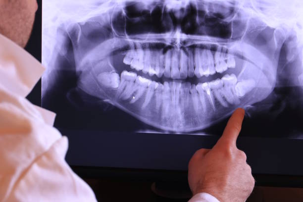 Best Emergency Dental Services for Seniors in East Camden, AR
