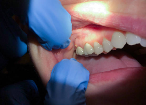 Best Emergency Dentist for Knocked-Out Tooth in East Camden, AR