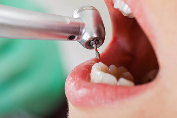 Best Mobile Emergency Dentist in East Camden, AR